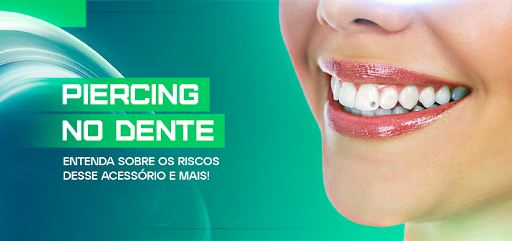 Piercing no dente: entenda sobre os riscos desse acessório e mais! – Aditek